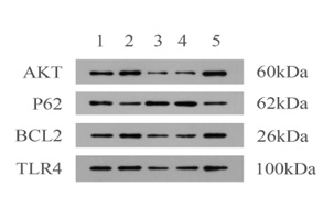 Western Blot：探索蛋白质表达与相互作用的有力工具