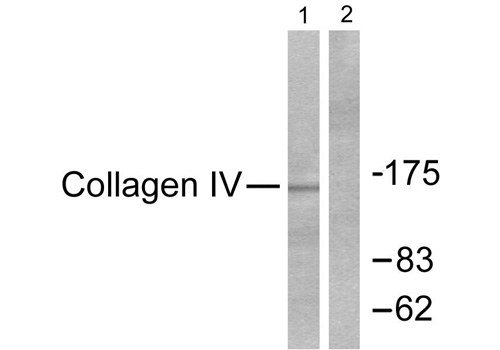 Collagen IV Antibody