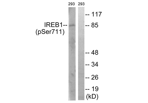 Phospho-IREB1 (Ser711) Antibody