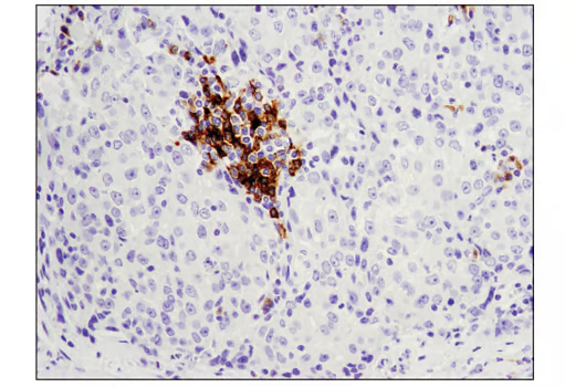 Anti- CD79b Rabbit mAb