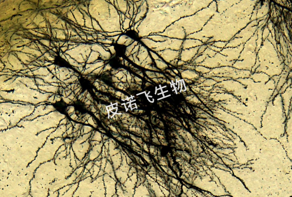 高尔基 脑