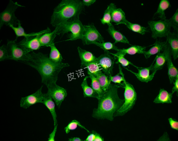 a-Actin 绿 ；PCNA 红