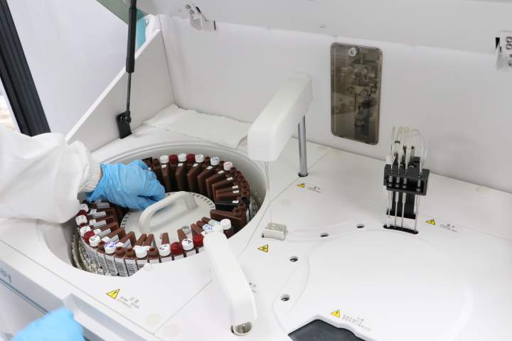 肝功能8项 谷丙转氨酶 ALT