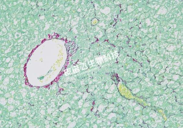 天狼猩红快绿法