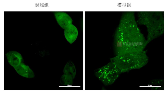 细胞自噬染色检测(MDC法)