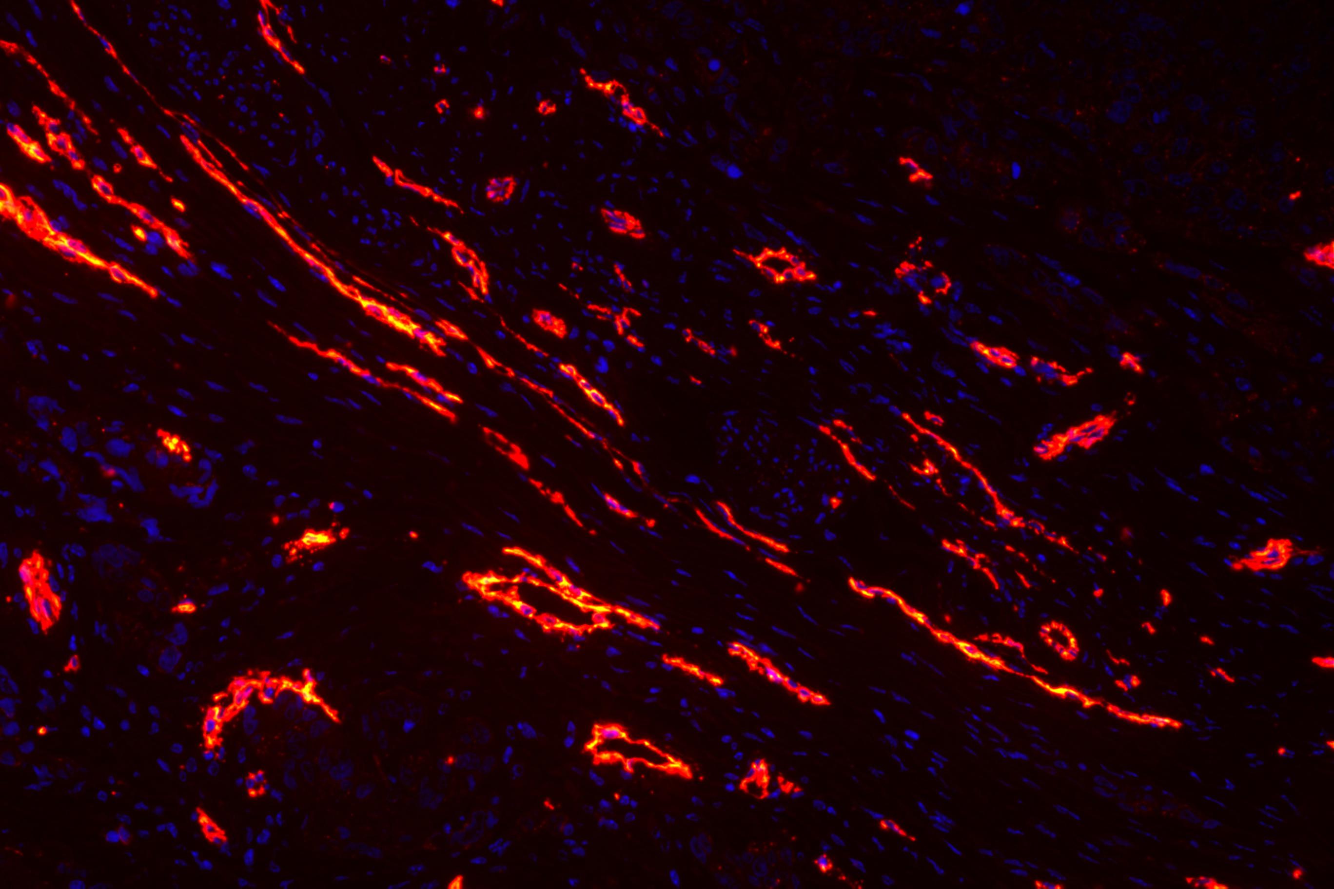 11肿瘤-200-1 cd31+dapi.jpg