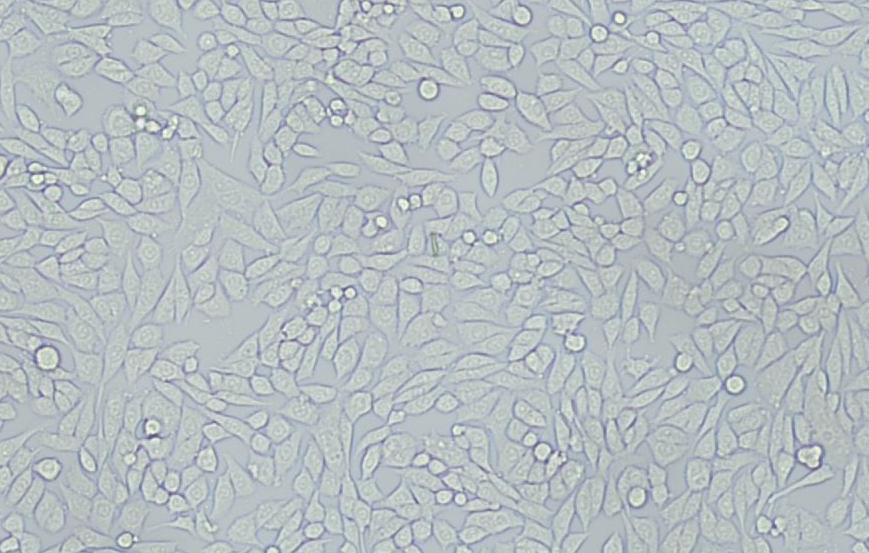 冰冻切片作免疫荧光染色的固定剂选择：科学与艺术的完美结合