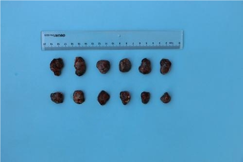 小鼠皮下移植瘤药效评估