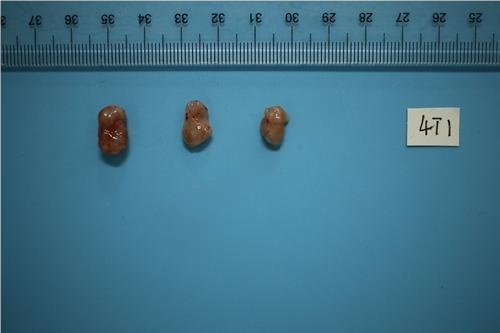 小鼠乳腺癌原位瘤