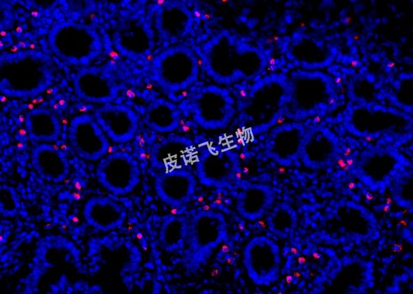 原位杂交（FISH双标）